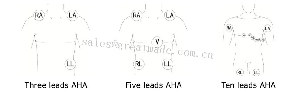 এমসি 人体 图