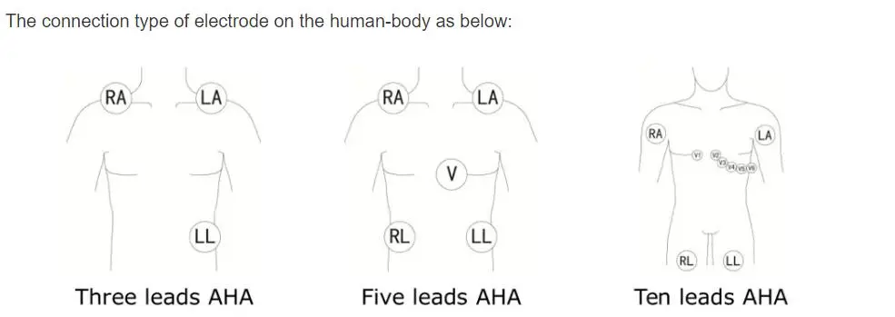 ফিলিপস ডিজিটরাক প্লাস 24 ঘন্টা হোল্টার 3100 এ, 5-সীসা, স্ন্যাপের জন্য 5-লিড ইসিজি নেতৃত্বাধীন